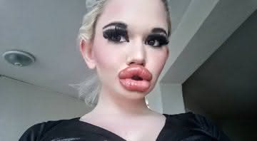 Andrea Ivanova, búlgara de 22 anos, quer ter os maiores lábios do mundo - Instagram