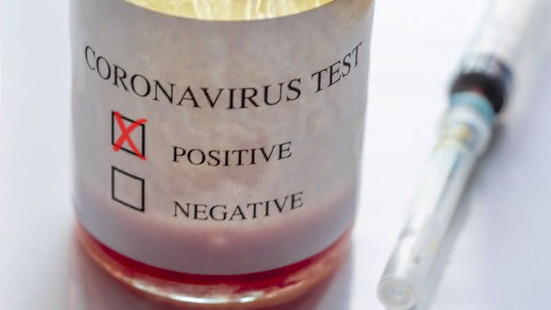 Coronavírus está deixando o mundo em alerta - Getty Images
