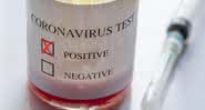 Coronavírus está deixando o mundo em alerta - Getty Images