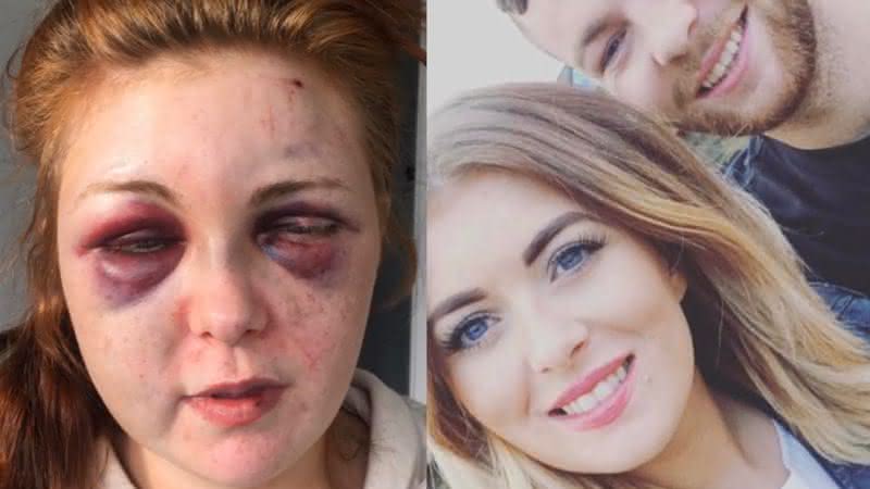 Jessa Hurley foi brutalmente agredida por Mark Whiteside, pai de sua filha - The Sun