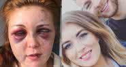 Jessa Hurley foi brutalmente agredida por Mark Whiteside, pai de sua filha - The Sun